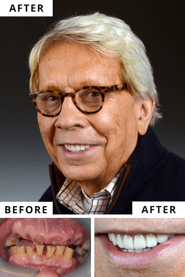 Dr. William Linger Dental Implants Charlotte NC